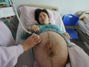 Mẹ bầu bị đau ở 3 vị trí này là dấu hiệu em bé trong bụng sắp thiếu canxi