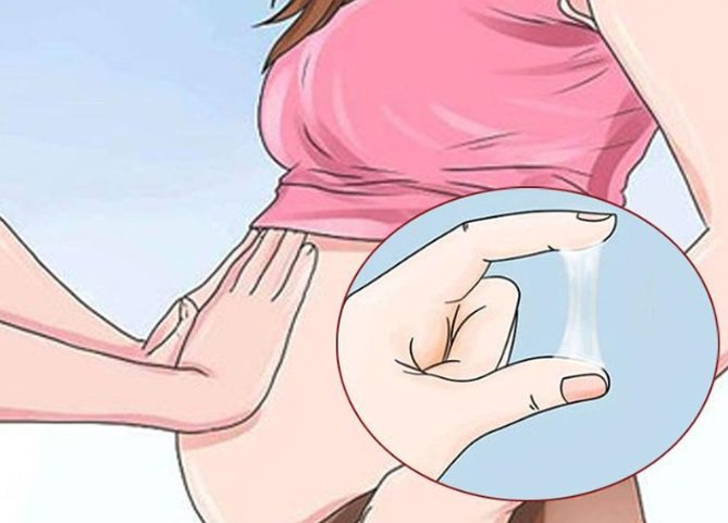 Ra khí hư khi mang thai có bình thường không? - 1