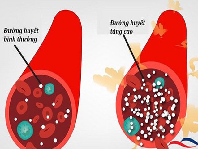 12 tác dụng của tỏi đen với sức khỏe và một số tác dụng phụ - 4