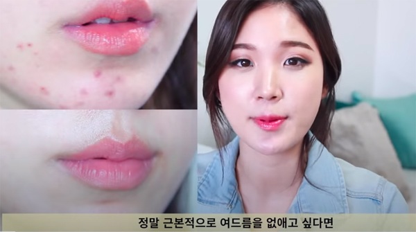 Beauty blogger Hàn chia sẻ nên và không nên ăn gì cho da mụn, nàng lưu ngay vào thực hiện - 1