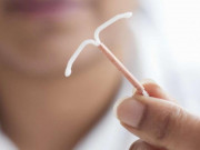 Đặt vòng tránh thai có đau không và những giải đáp cần biết
