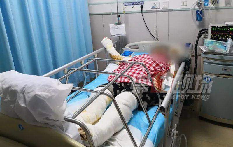 nau an tai nha ma khong dong cua so, nguoi phu nu bi set danh bong ca nguoi va mat - 1