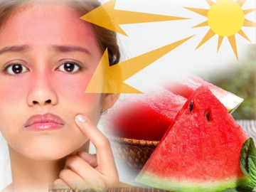 Ăn ngay 5 loại rau quả này tốt chẳng kém kem chống nắng, ngừa tia UV lẫn ung thư da
