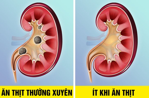 Nếu có 10 biểu hiện này, bạn nên hạn chế lại sở thích ăn thịt dù luộc, rán hay nướng - 1