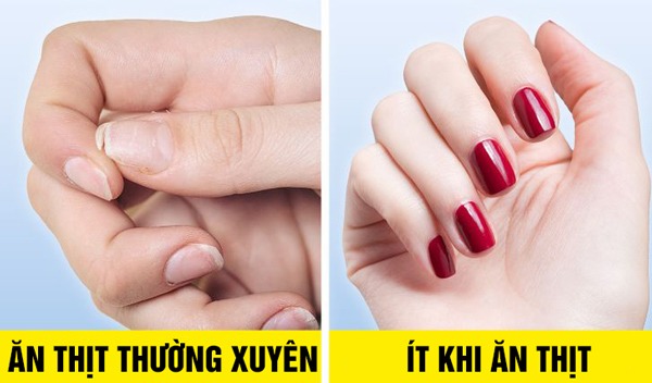 Nếu có 10 biểu hiện này, bạn nên hạn chế lại sở thích ăn thịt dù luộc, rán hay nướng - 9