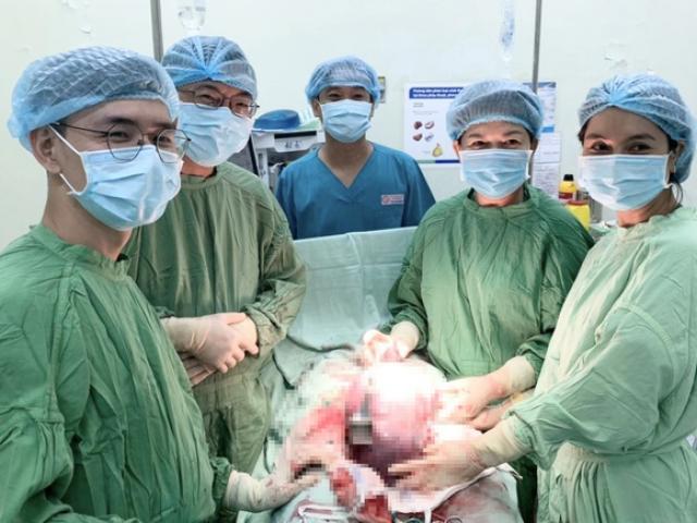 Mổ lấy thai cho mẹ Đồng Tháp, bác sĩ lấy ra khối u to tròn lớn hơn cả em bé