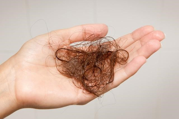 Giải pháp đột phá chấm dứt ác mộng rụng tóc cho phụ nữ