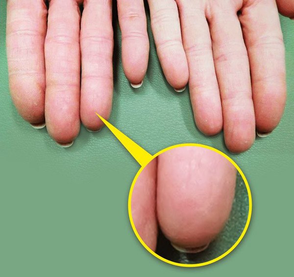 12 điều kỳ lạ về cơ thể con người mà các nhà khoa học không thể giải thích nổi - 11