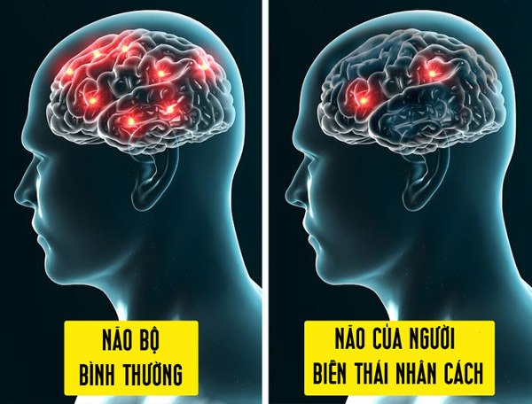 12 điều kỳ lạ về cơ thể con người mà các nhà khoa học không thể giải thích nổi - 12
