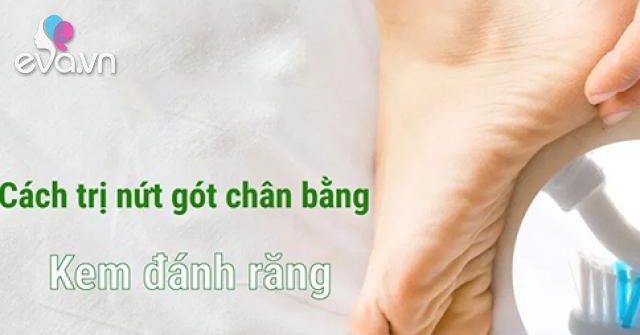 10 Cách trị nứt gót chân tại nhà tự nhiên an toàn hiệu quả nhanh nhất - 1 - Eva.vn