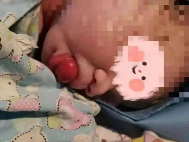 Sau 7 lần sảy thai, người mẹ 35 tuổi đau đớn khi sinh ra đứa con ngậm ngọc rồng