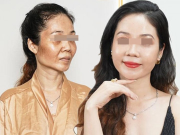Làm đẹp tái sinh đa tầng, nhiều chị em feedback tốn tiền mà cứ như rửa mặt ở quán gội đầu