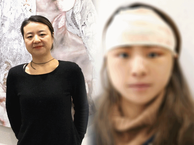 "Cắt da mặt" được 1 tháng, người phụ nữ 48 tuổi "cải lão hoàn đồng", biến thành người khác