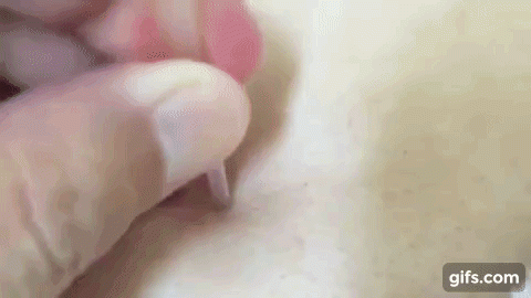 khong can nan, mun dau den van tu troi len voi 2 cach cuc don gian duoi day - 7