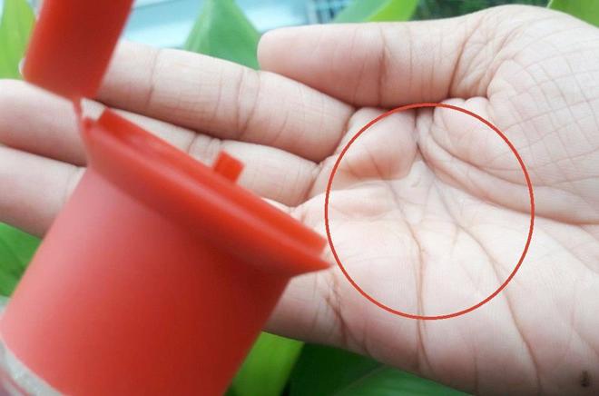 diem mat 5 toner lam sach kiem tri mun luon trong tinh trang het hang vi qua hot! - 2