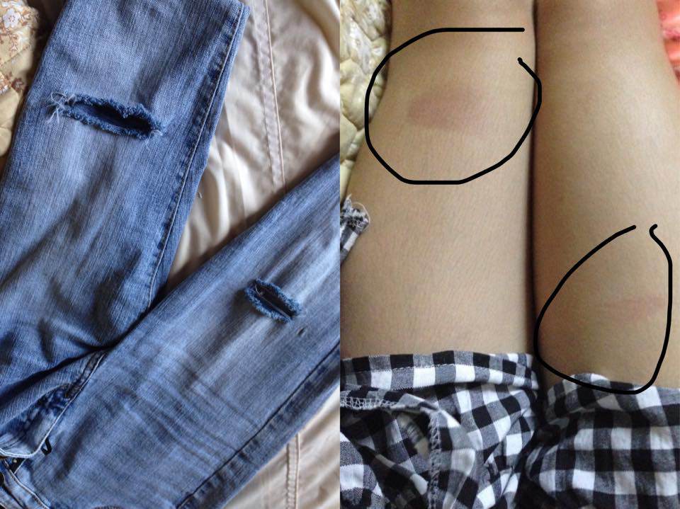 nang nong cuc do, chi em nhan cai ket "meo mat" khi mac jeans rach ra duong - 2