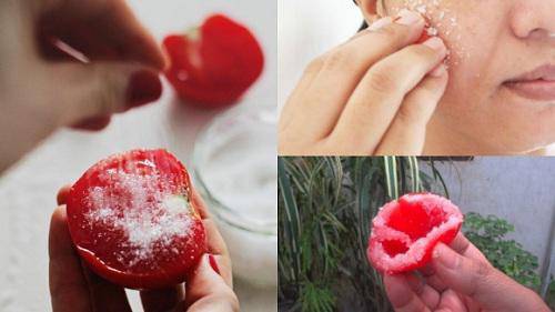 cach tri mun boc tra lai lan da cang bong, ai ma khong biet la phi ca doi! - 2