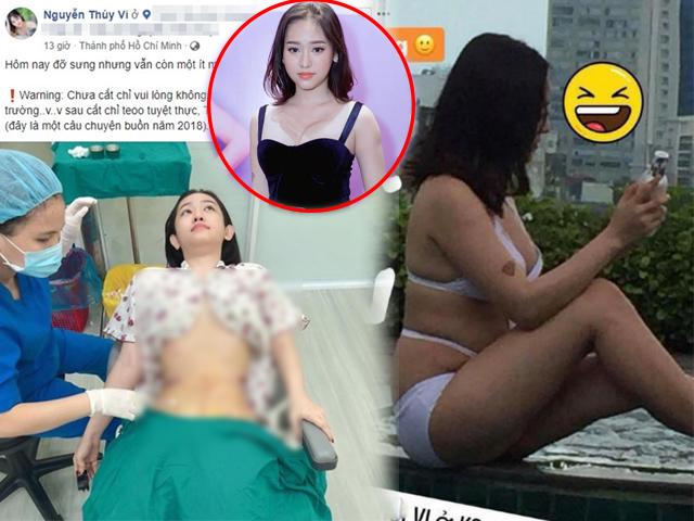 Hotgirl Cà Mau Thúy Vi bạo tay chi 170 triệu để hút 2kg mỡ bụng rồi... bơm vào mông