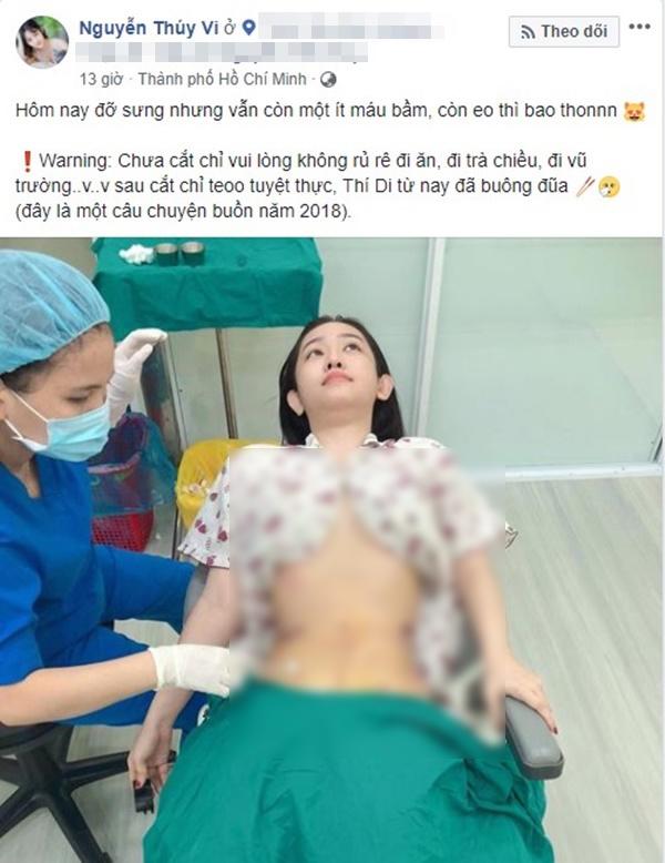 "hotgirl ca mau" thuy vi bao tay chi 170 trieu de hut 2kg mo bung roi... bom vao mong - 1