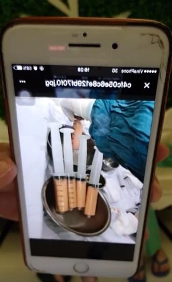 "hotgirl ca mau" thuy vi bao tay chi 170 trieu de hut 2kg mo bung roi... bom vao mong - 4