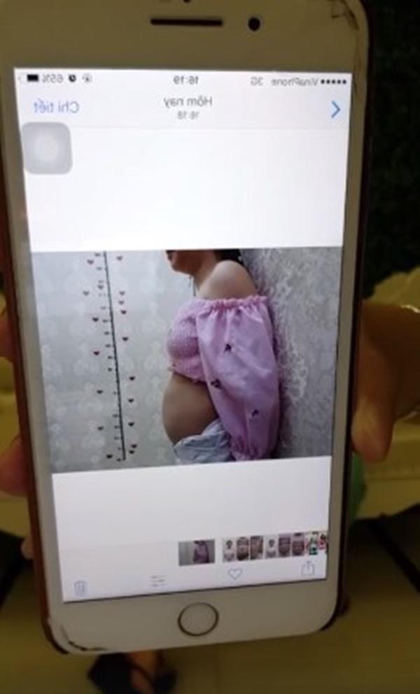 "hotgirl ca mau" thuy vi bao tay chi 170 trieu de hut 2kg mo bung roi... bom vao mong - 6