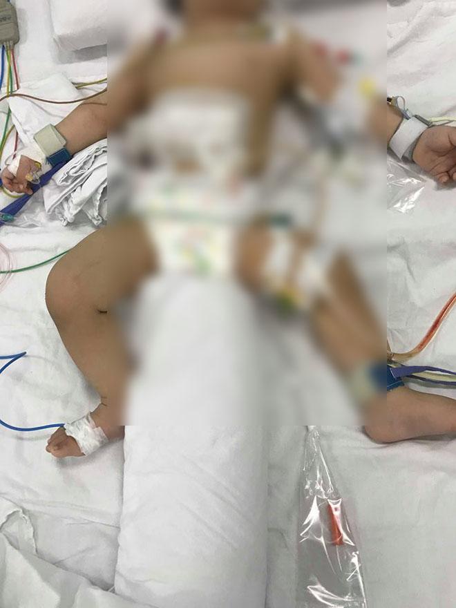 ba ngoai bang hoang chung kien canh chau trai bi me ruot cam dao dam 8 nhat vao bung - 1