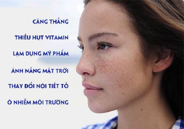 Cách trị tàn nhang tại nhà 10 người dùng 9 người mê, da cứ thế căng bóng, trắng mịn - 2