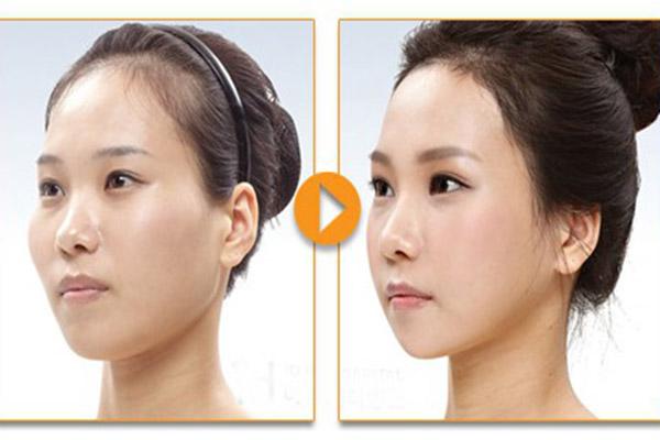 mong thoat khoi tieng xau "sat phu", co nang nay da chi hang tram trieu chi de ha go ma - 2