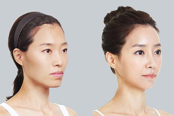 mong thoat khoi tieng xau "sat phu", co nang nay da chi hang tram trieu chi de ha go ma - 5