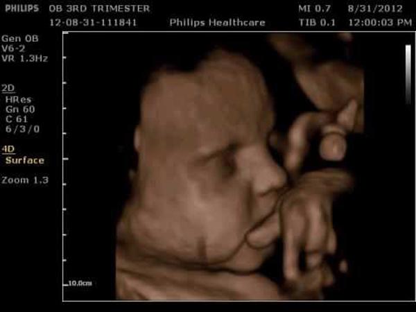 Với siêu âm 7 lần, bạn có thể quan sát rõ ràng hơn về sự phát triển của thai nhi và các bộ phận cơ thể. Hãy tận hưởng những khoảnh khắc đáng nhớ trong quá trình mang thai bằng cách xem những hình ảnh siêu âm 7 lần của bé yêu nhà bạn.