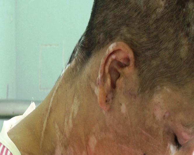 nu giup viec 9x bi chu nha tra tan nhu thoi trung co den bien dang, say thai - 1