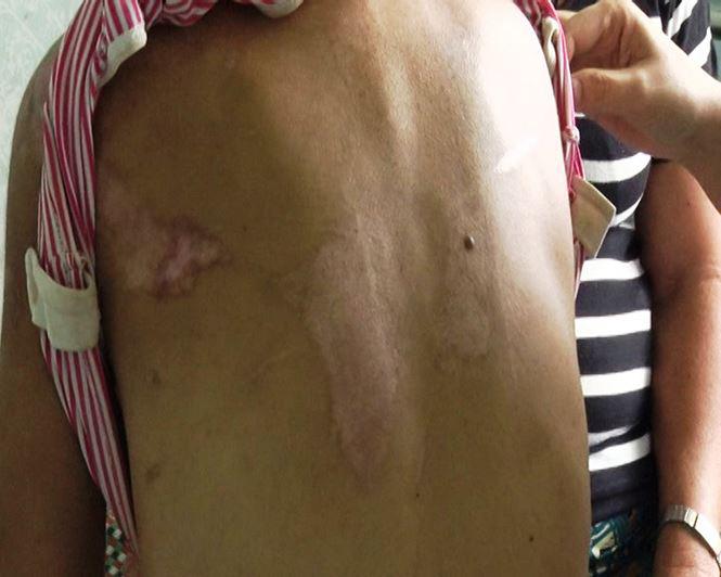 nu giup viec 9x bi chu nha tra tan nhu thoi trung co den bien dang, say thai - 2