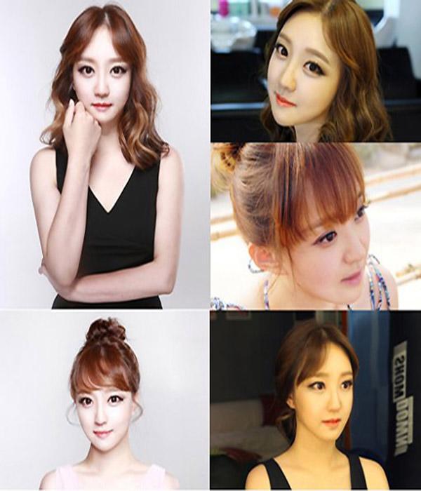 hau phau thuat tham my: chang the len may bay, con khoc thet vi khong nhan ra me - 4