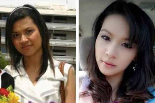 hau phau thuat tham my: chang the len may bay, con khoc thet vi khong nhan ra me - 6