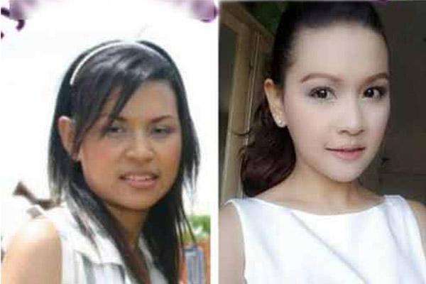 hau phau thuat tham my: chang the len may bay, con khoc thet vi khong nhan ra me - 7