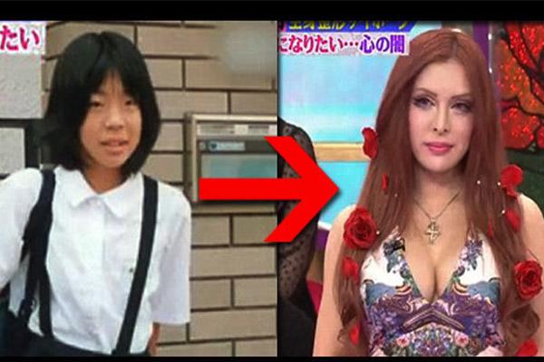 hau phau thuat tham my: chang the len may bay, con khoc thet vi khong nhan ra me - 8