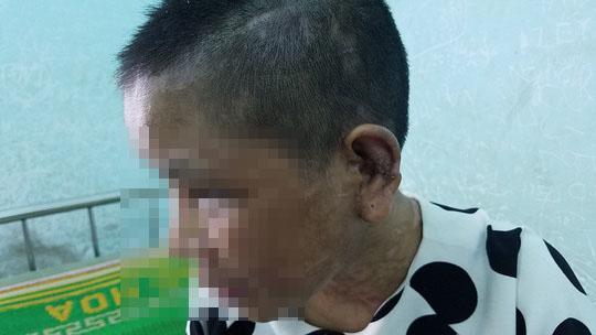 loi ke kinh hoang cua co gai nghi bi chu tra tan: "danh vao vung kin den say thai" - 2