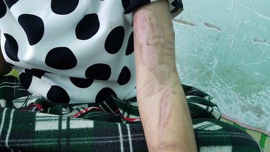 loi ke kinh hoang cua co gai nghi bi chu tra tan: "danh vao vung kin den say thai" - 4