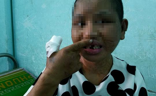 tin tuc 24h: vo lao vao danh ghen, chong can kich liet va cai ket bat ngo cho co bo - 2