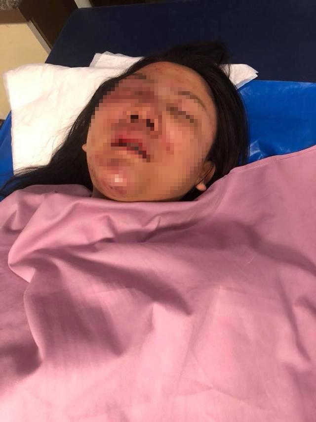 chang trai chuyen gioi danh ban gai da man trong ham gui xe: "danh cho em ca trai tim nay" - 4