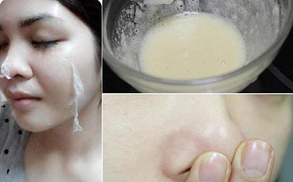 dap mat na ca nam mun dau den van deo bam, ban phai cho them 1 muong thu nay - 5