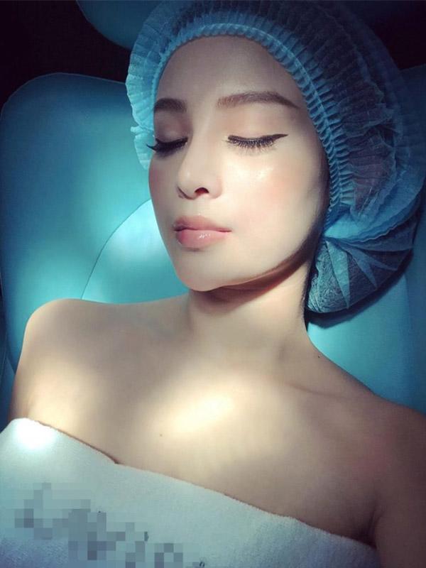 de keo dai sac xuan, me hai con huyen baby khong ngai chia se can canh tiem filler ranh moi - 7