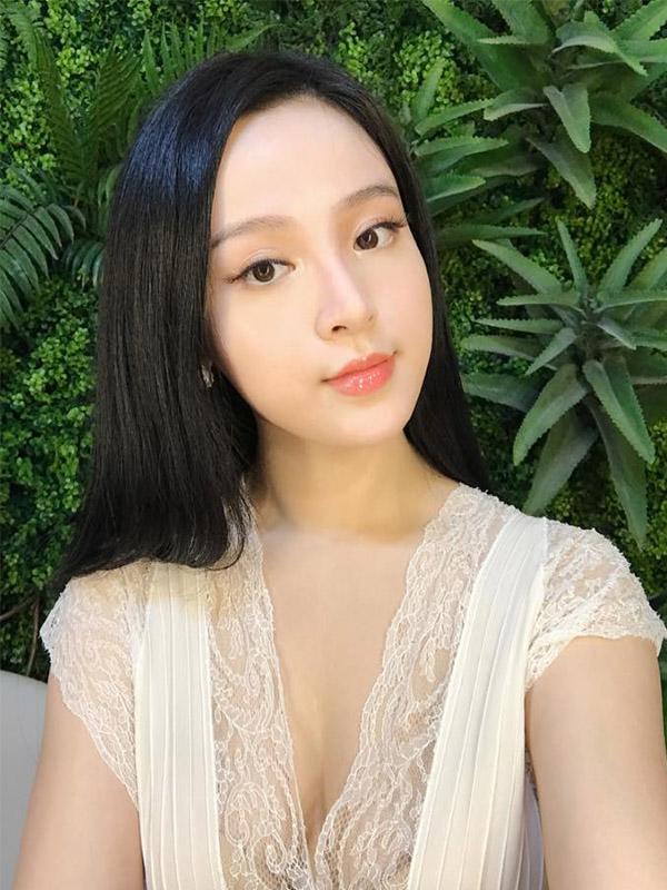 de keo dai sac xuan, me hai con huyen baby khong ngai chia se can canh tiem filler ranh moi - 1