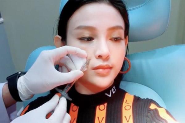 de keo dai sac xuan, me hai con huyen baby khong ngai chia se can canh tiem filler ranh moi - 4