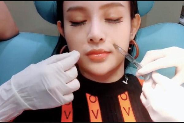 de keo dai sac xuan, me hai con huyen baby khong ngai chia se can canh tiem filler ranh moi - 5