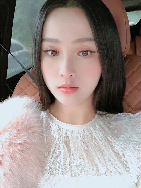 de keo dai sac xuan, me hai con huyen baby khong ngai chia se can canh tiem filler ranh moi - 12