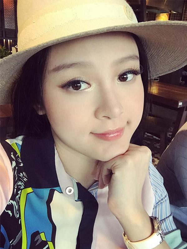 de keo dai sac xuan, me hai con huyen baby khong ngai chia se can canh tiem filler ranh moi - 3