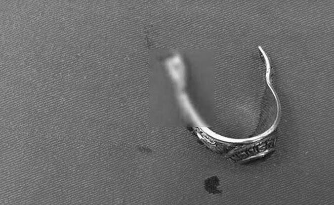 tim cam giac la, nam thanh nien deo nhan vao "cua quy" roi tai mat "cau cuu" bac si - 3