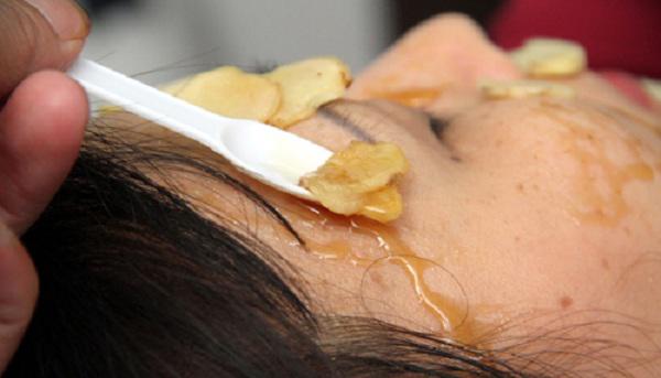 ap dung 5 cach tri mun tham 100% thien nhien de lay lai lan da cang bong, min mang - 4