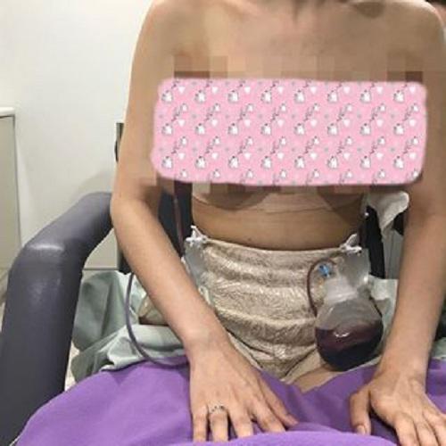 nguoi dep thai dam don doi 14 ty vi suyt chet sau ca nang nguc - 5